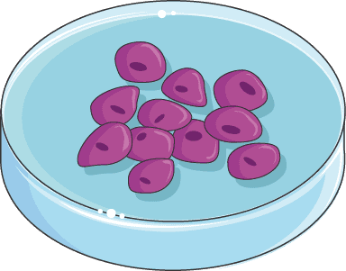 Extrahierte Tumorzellen in Petrischale